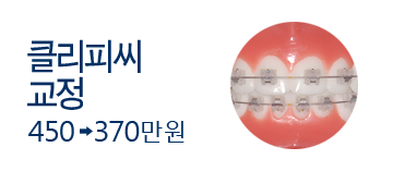 클리피씨 교정 450(X) -> 370(O) 분납가능 진단비, 발치비, 유지장치비 포함